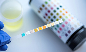Urinalysis
