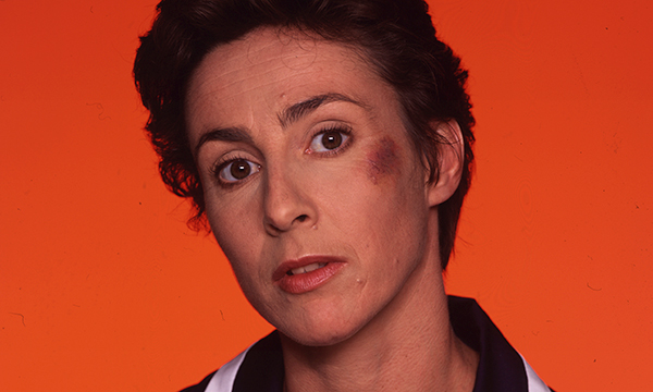 Nurse with bruise