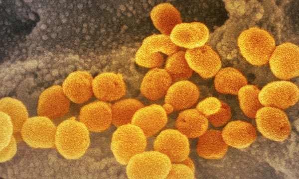 Covid-19 coronavirus particles. The NMC stated it will consider context for fitness to practise cases that relate to care given during a possible widespread coronavirus outbreak 