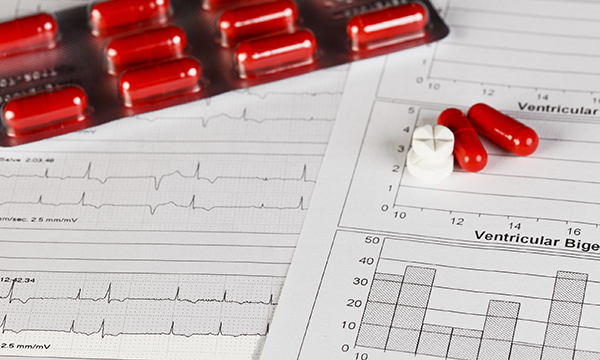 Beta Blockers