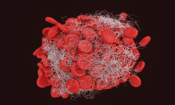 Coagulation