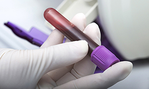 Blood sample