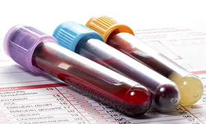 Blood sample