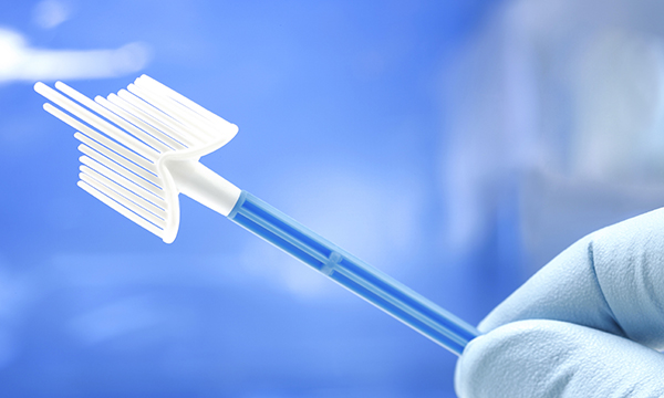 Cervical screening