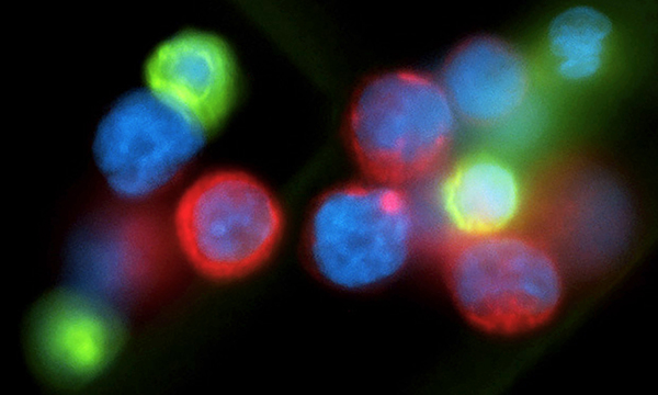 cancer cells 