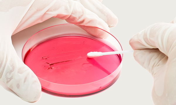 Petri dish