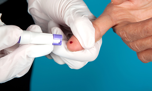 HIV testing