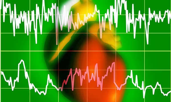Irregular heartbeat