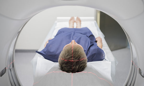 MRI scan