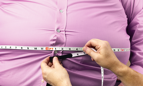 Morbid obesity