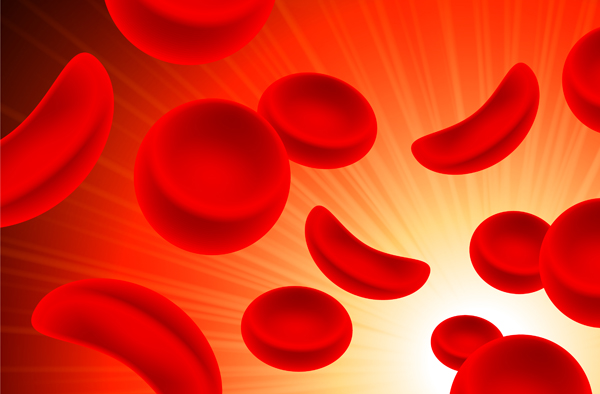 Sickle cell