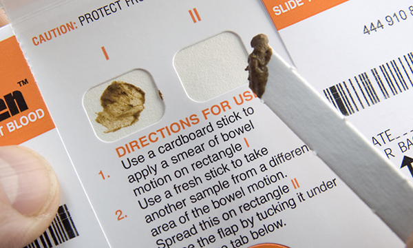Stool blood test