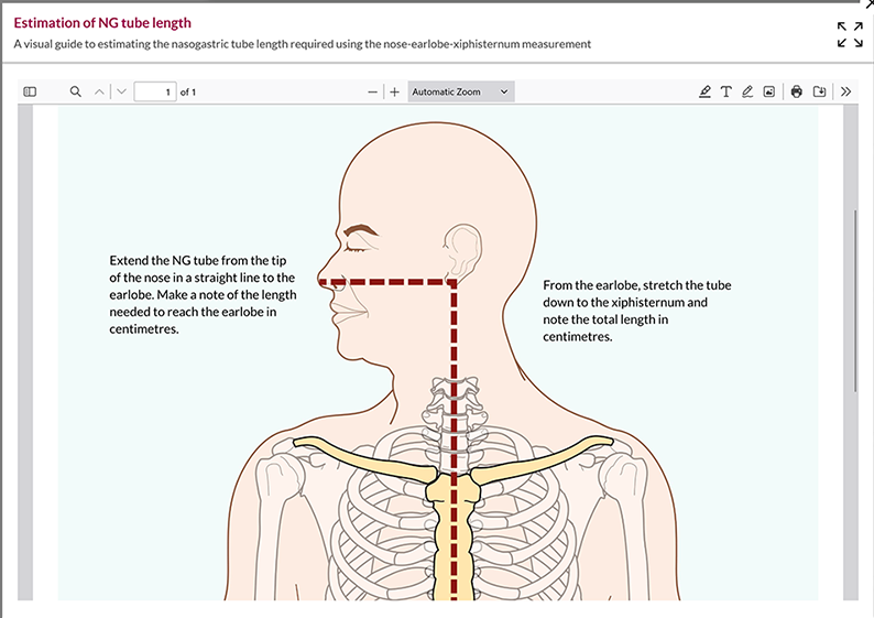 RCNi learning nursing toolkit launch NG tube length