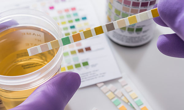 UTI test