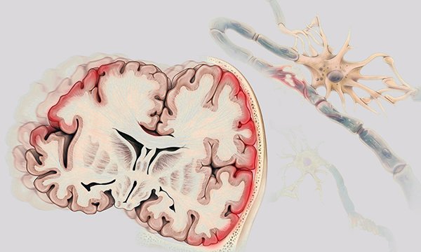 Undertaking a systematic assessment of patients with a traumatic brain injury