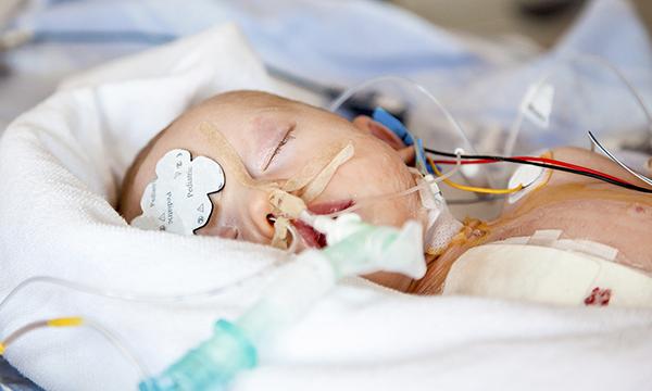 Heart surgery