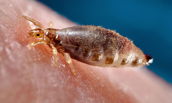 Louse