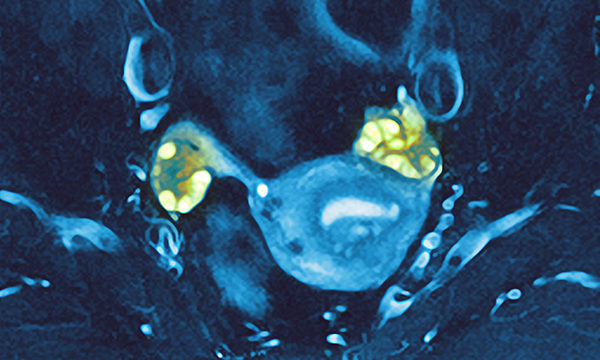 ovary