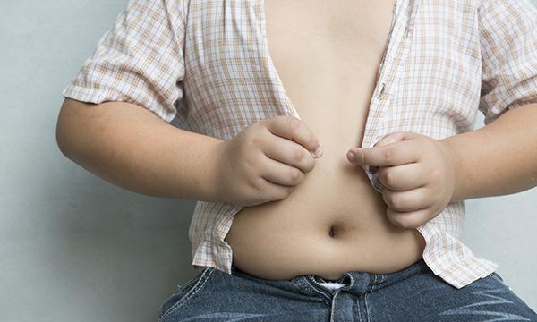 Obesity