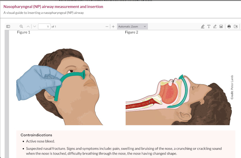 RCNi learning nursing toolkit launch airway measurement